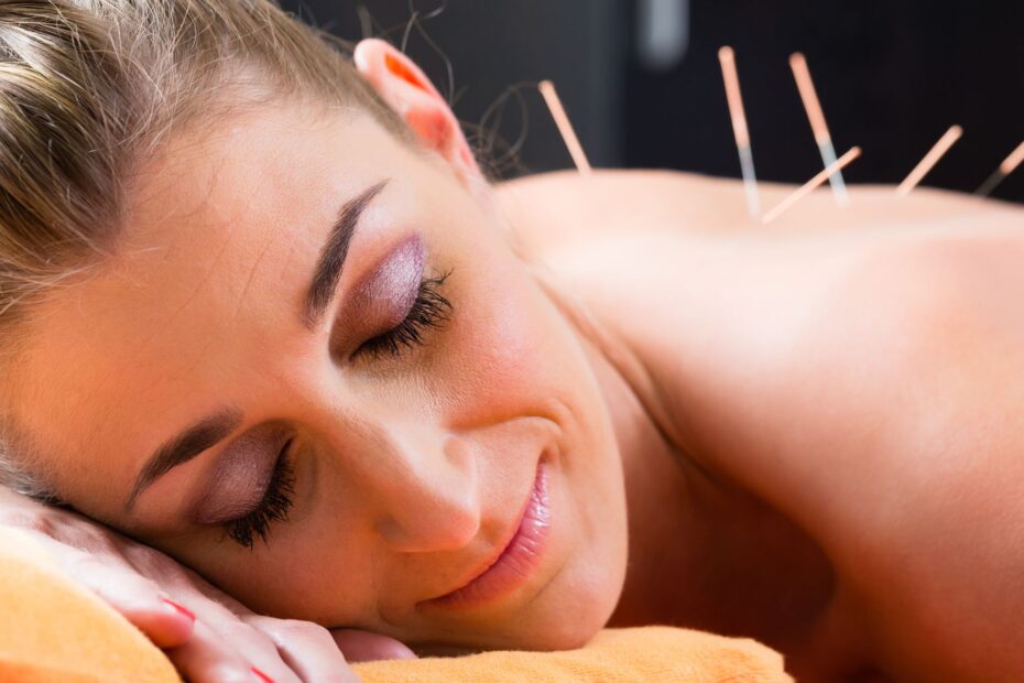 Acupuncture treatment included in the body reset retreat